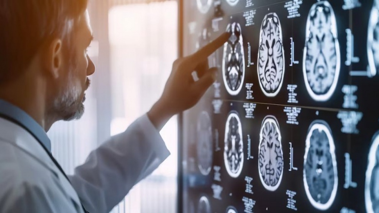 Científicos internacionales evalúan una herramienta que identifica tumores con más del 97% de precisión