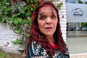La lucha de Susi Alanis: Su enfermedad avanza, las dificultades crecen y un pedido para poder continuar con sus tratamientos médicos